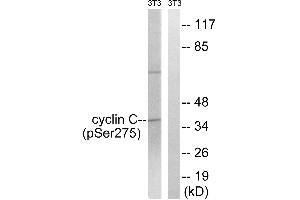 Immunohistochemistry analysis of paraffin-embedded human breast carcinoma tissue using Cyclin C (Phospho-Ser275) antibody. (Cyclin C antibody  (pSer275))