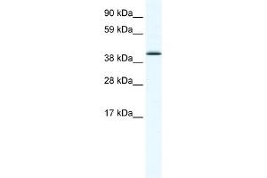 WB Suggested Anti-SOX7 Antibody Titration:  1. (SOX7 antibody  (N-Term))