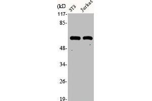 Western Blot analysis of NIH-3T3 Jurkat cells using Cytokeratin 10 Polyclonal Antibody (Cytokeratin 1 antibody  (Internal Region))