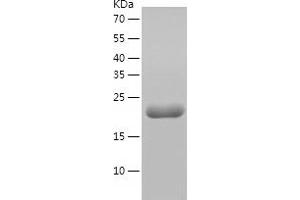 Western Blotting (WB) image for EF-Hand Calcium Binding Domain 7 (EFCAB7) (AA 1-203) protein (His tag) (ABIN7284191) (EFCAB7 Protein (AA 1-203) (His tag))