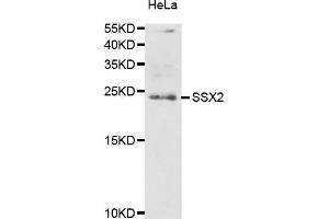 Western blot analysis of extracts of HeLa cells, using SSX2 antibody (ABIN5974203) at 1/1000 dilution. (SSX2 antibody)