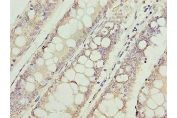 VPS45 antibody  (AA 101-400)