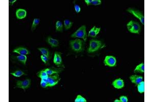 Immunofluorescent analysis of MCF-7 cells using ABIN7159387 at dilution of 1:100 and Alexa Fluor 488-congugated AffiniPure Goat Anti-Rabbit IgG(H+L) (MS4A4A antibody  (AA 1-64))