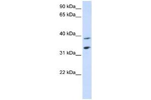 Western Blotting (WB) image for anti-Solute Carrier Family 25, Member 34 (SLC25A34) antibody (ABIN2458822)
