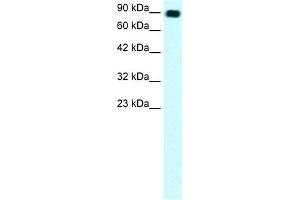 WB Suggested Anti-C13ORF8 Antibody Titration: 1. (ZNF828 antibody  (Middle Region))