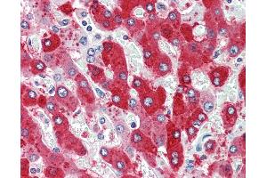 Human, Liver: Formalin-Fixed Paraffin-Embedded (FFPE) (CDCP1 antibody  (N-Term))