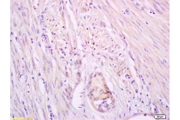 beta Catenin antibody  (pSer33, pSer37)
