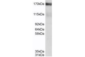 ABCC4 antibody  (C-Term)