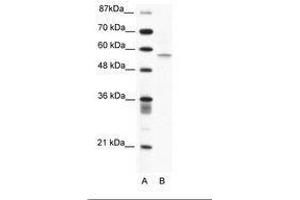 Image no. 1 for anti-Programmed Cell Death 4 (PDCD4) (N-Term) antibody (ABIN203165) (PDCD4 antibody  (N-Term))