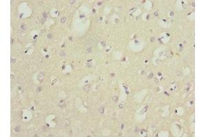 Immunohistochemistry of paraffin-embedded human brain tissue using ABIN7165131 at dilution of 1:100