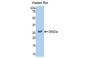 Western Blotting (WB) image for anti-Glycine Dehydrogenase (GLDC) (AA 627-833) antibody (ABIN1859022) (GLDC antibody  (AA 627-833))