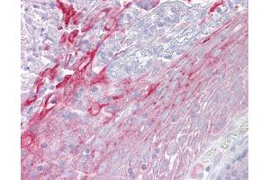 Anti-CFP / Properdin antibody IHC of human tonsil. (CFP antibody  (AA 35-84))