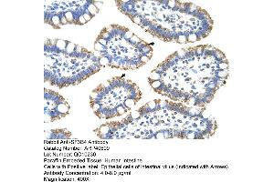 Rabbit Anti-SF3B4 Antibody  Paraffin Embedded Tissue: Human Intestine Cellular Data: Epithelial cells of intestinal villas Antibody Concentration: 4. (SF3B4 antibody  (N-Term))