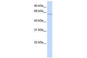 ME2 antibody used at 1 ug/ml to detect target protein. (NAD-ME antibody)