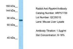 Western Blotting (WB) image for anti-Protein Phosphatase 4, Regulatory Subunit 4 (PPP4R4) (C-Term) antibody (ABIN2787350) (PPP4R4 antibody  (C-Term))