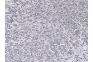 IHC-P analysis of Mouse Stomach Tissue, with DAB staining. (ADAMTS7 antibody  (AA 226-437))