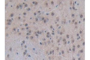 DAB staining on IHC-P; Samples: Mouse Brain Tissue (p300 antibody  (AA 2124-2397))