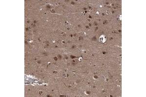 Immunohistochemical staining of human cerebral cortex with SYCP2L polyclonal antibody  shows distinct cytoplasmic and nuclear positivity in neuronal cells at 1:200-1:500 dilution. (SYCP2L antibody)