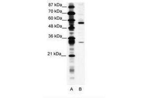 Image no. 1 for anti-Coronin, Actin Binding Protein, 1A (CORO1A) (C-Term) antibody (ABIN305990) (Coronin 1a antibody  (C-Term))
