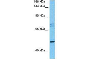 Host:  Mouse  Target Name:  PKD2  Sample Tissue:  Mouse Heart  Antibody Dilution:  1ug/ml (PKD2 antibody  (N-Term))
