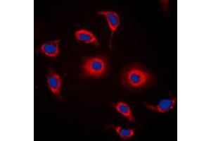 Immunofluorescent analysis of GPR119 staining in HeLa cells. (G Protein-Coupled Receptor 119 antibody  (Center))