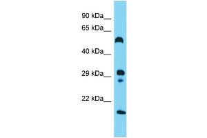 Host: Rabbit  Target Name: Hrh3  Sample Tissue: Rat Small Intestine lysates  Antibody Dilution: 1. (HRH3 antibody  (N-Term))