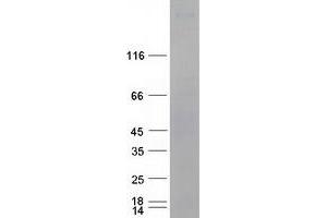 Validation with Western Blot