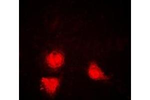Immunofluorescent analysis of SIRT1 staining in Jurkat cells. (SIRT1 antibody)