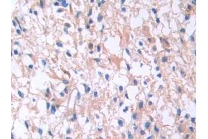 Used in DAB staining on fromalin fixed paraffin- embedded kidney tissue (IL13 Receptor alpha 1 antibody  (AA 203-376))
