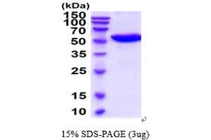 SDS-PAGE (SDS) image for TIMP Metallopeptidase Inhibitor 4 (TIMP4) (AA 30-224) protein (His tag) (ABIN5778686)