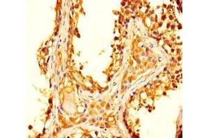 Immunohistochemistry of paraffin-embedded human testis tissue using ABIN7172582 at dilution of 1:100