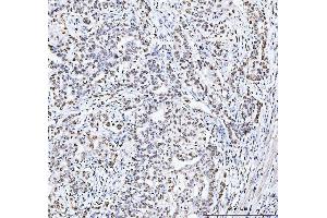 IHC analysis of MCM6 using anti-MCM6 antibody (ABIN7600038). (MCM6 antibody  (AA 14-821))