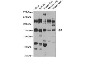 Western blot analysis of extracts of various cell lines, using ICK antibody (ABIN6130510, ABIN6142127, ABIN6142128 and ABIN6223738) at 1:1000 dilution. (ICK antibody  (AA 1-270))