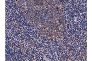 Image no. 8 for anti-COBW Domain Containing 1 (CBWD1) antibody (ABIN1497117) (CBWD1 antibody)