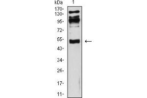 Western Blotting (WB) image for anti-Interferon gamma Receptor 1 (IFNGR1) (AA 18-245) antibody (ABIN5611138)