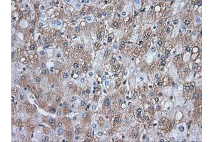 Image no. 9 for anti-Transforming, Acidic Coiled-Coil Containing Protein 3 (TACC3) antibody (ABIN1498099) (TACC3 antibody)