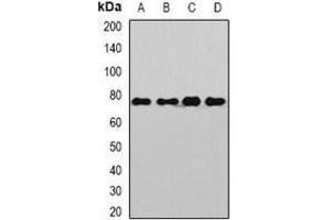 Western blot analysis of Sp110 expression in Jurkat (A), Hela (B), mouse liver (C), rat brain (D) whole cell lysates.