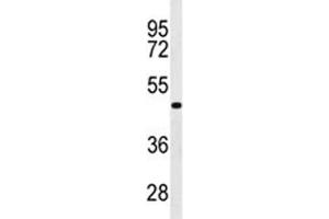 Western blot analysis of GATA6 antibody in WiDr lysate. (GATA6 antibody  (AA 254-279))