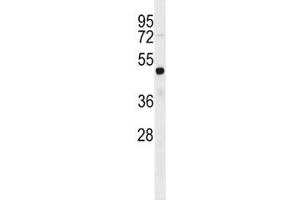 FEZF2 antibody western blot analysis in HL-60 lysate. (FEZF2 antibody  (AA 209-237))