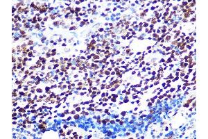 Immunohistochemistry of paraffin-embedded human appendix using K/H Rabbit mAb (ABIN7267702) at dilution of 1:100 (40x lens).