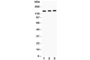 Western blot testing of IRS1 antibody and Lane 1:  A549;  2: MM453;  3: Jurkat. (IRS1 antibody  (AA 1041-1242))