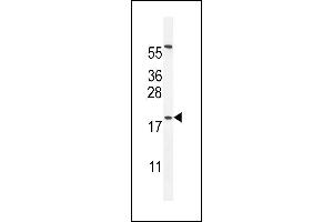 DA5 Antibody (N-term) (ABIN655277 and ABIN2844869) western blot analysis in HL-60 cell line lysates (35 μg/lane). (DPPA5 antibody  (N-Term))