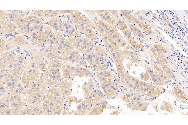 Luteinizing Hormone antibody