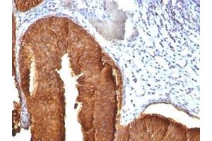 Immunohistochemistry (Formalin-fixed Paraffin-embedded Sections) (IHC (fp)) image for anti-Keratin 19 (KRT19) antibody (ABIN3025844)