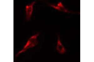 ABIN6275227 staining  Hela cells by IF/ICC. (MBTPS1 antibody  (Internal Region))
