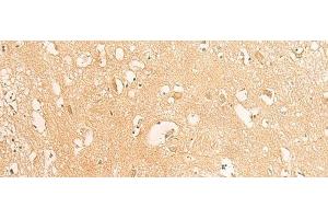 Immunohistochemistry of paraffin-embedded Human brain tissue using IFITM2 Polyclonal Antibody at dilution of 1:25(x200) (IFITM2 antibody)