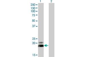 Western Blot analysis of HAND2 expression in transfected 293T cell line by HAND2 monoclonal antibody (M06), clone 3D5. (HAND2 antibody  (AA 135-216))