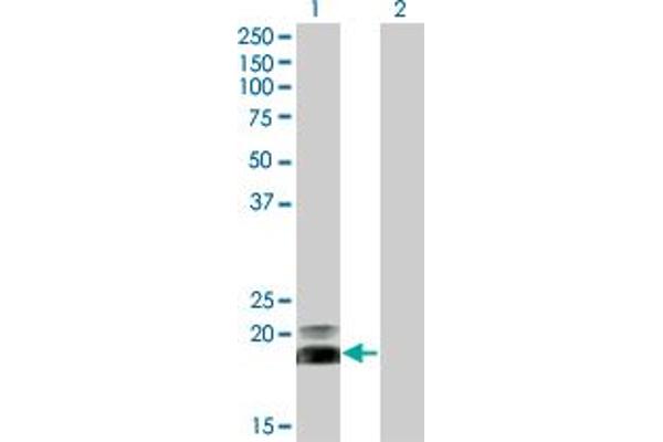 HAND2 anticorps  (AA 135-216)