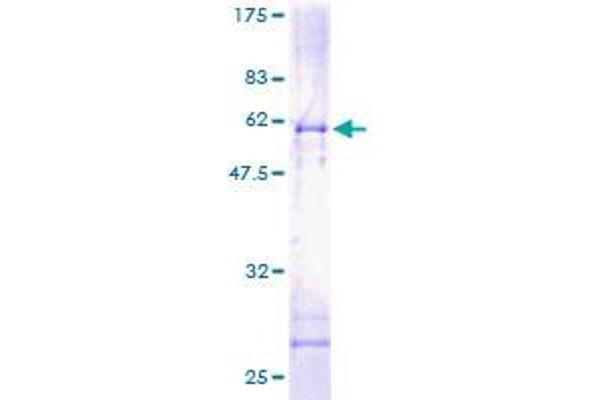 EI24 Protein (AA 1-340) (GST tag)
