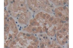 Detection of AATK in Human Kidney Tissue using Polyclonal Antibody to Apoptosis Associated Tyrosine Kinase (AATK)
